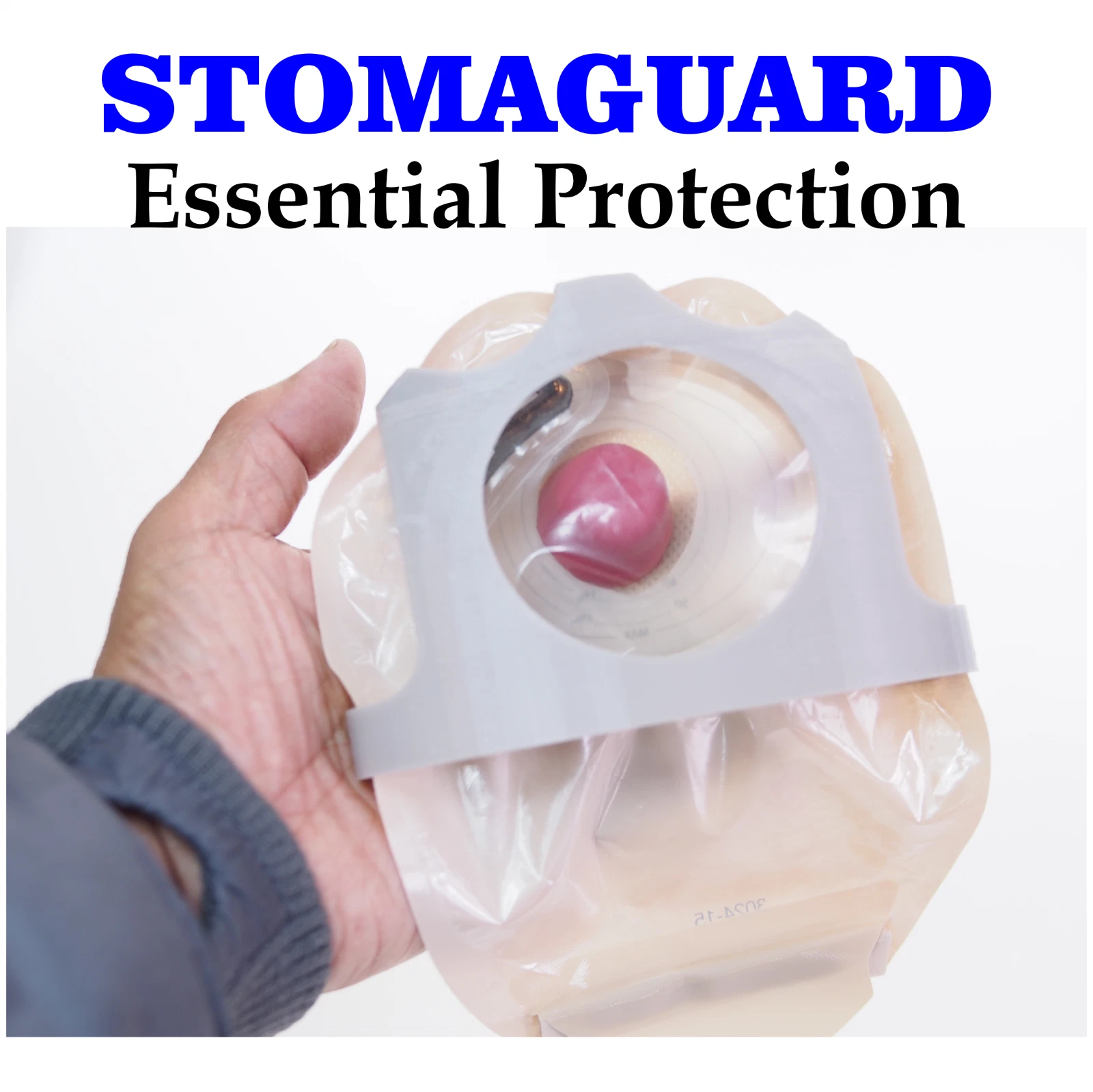 STOMAGUARD stoma protector fitted over a colostomy pouch